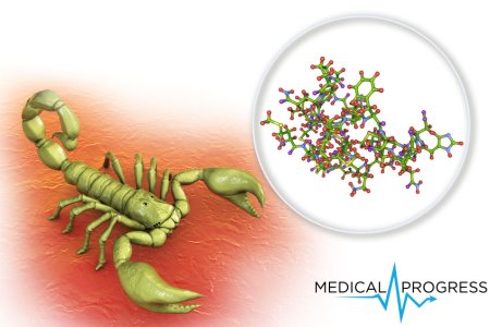 Toksyna skorpiona atakująca "receptor wasabi" może pomóc rozwiązać zagadkę przewlekłego bólu
