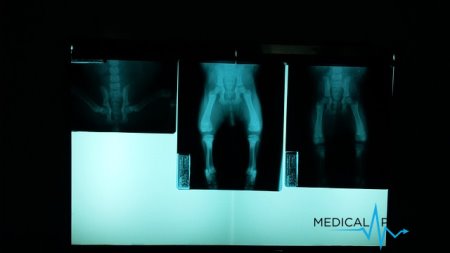 Technologia obrazowania optycznego ulepszy mapowanie guzów w ludzkim ciele
